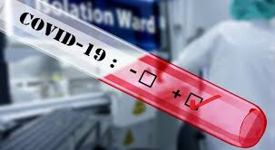 Pcr & antikörpertest corona virus. Coronavirus Test Dauer Und Kosten So Lassen Sie Sich Testen