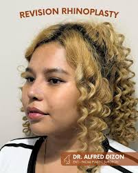 Dr. Alfred Dizon (@drdizonent)