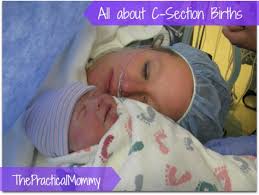 While preparing for fatherhood, its important to have a discussion on where the baby will sleep as it is also basically a discussion about future sleep training. Having A C Section What You Should Know Wehavekids
