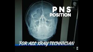 Pns Pns Water View Positioning Anatomy And Physiology Part 21
