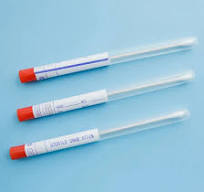 Medical Flocking Flu Oral Nasal Specimen Collection Transport Swab Anal  Cervix Vagina Swab in Tube