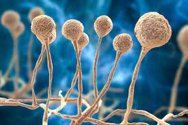 The infected patient is currently undergoing treatment at a hospital in ghaziabad. What Is Black White And Yellow Fungus How Can It Be Prevented By Usha Ayyagari Activ Living Blog
