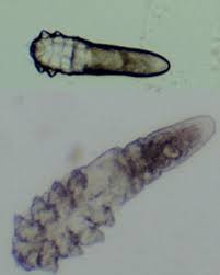 Image result for Demodex brevis