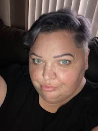 Does gastric sleeve help with double chin?