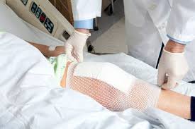 Check spelling or type a new query. Xarelto Uses Dosing Interactions With The Blood Thinner