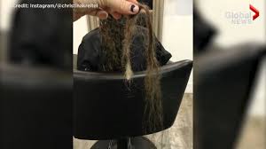 During pregnancy, your hair might be thick and lustrous. Woman S Extreme Postpartum Hair Loss Goes Viral National Globalnews Ca