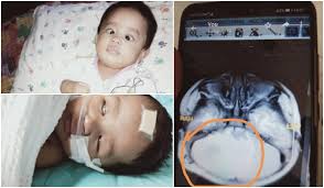 Bayi yang belum bersendawa berisiko gumoh, bahkan hingga kolik karena ada udara sangat penting untuk membuat bayi bersendawa setelah menyusu. Tak Sangka Muntah Berlarutan Petanda Anak Bongsu Hidap Penyakit Kronik