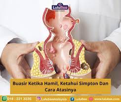 Apabila seseorang mengalami sembelit dan cuba meneran najis yang mengeras di dalam kolon dengan kuat ketika membuang air besar, struktur. Buasir Ketika Hamil Lulubae