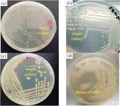 Anugerah saintifik sdn bhd (assb) is a gdpmd and mda medical and laboratory equipment certified supplier based in bandar kinrara, selangor. Bio Inspired Self Healing Of Concrete Cracks Using New B Pseudomycoides Species Sciencedirect