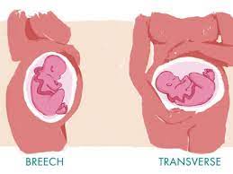 Positions Please How Babies Worlds Turn