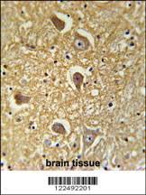 The igg antibody secretory cells (ascs) in small intestine were particularly observed through immumohistochemical staining, then after were analyzed by statistical methods. Has2 Antibody Mybiosource