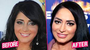 Find out which plastic surgery procedures are performed most often. Jersey Shore Cast S Shocking Plastic Surgery Transformations Revealed