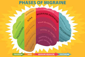 Difference Between In 2020 Migraine Cure Cluster Headaches Migraine Aura