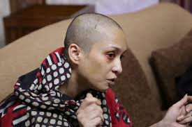 Woman says husband beat her, shaved her head for dance refusal