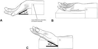 Alternatively search google for fds/fdp. The Effect Of Wrist Position On Finger Tendon Loads Following Pulley Sectioning And Operative Reconstruction Sciencedirect