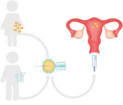 Es una gestación subrogada abandonada, porque gracias a los avances de la ciencia ya no es. O Que Es La Maternidad Subrogada Definicion Vittoriavita