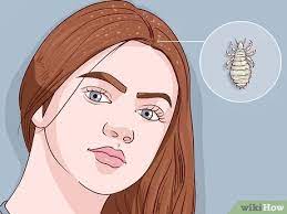 Check the hair once again for any stray lice or nits. 4 Ways To Remove Nits From Hair Wikihow