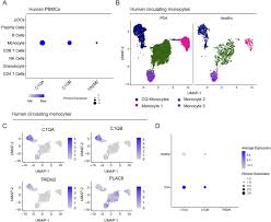 Sometimes, instead, many different ribbons are combined together to represent all cancers. Pancreatic Cancer Is Marked By Complement High Blood Monocytes And Tumor Associated Macrophages Life Science Alliance