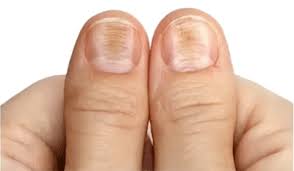 Tekorten Kenmerken Vrolijkweerzien