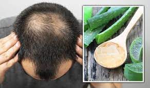2 aloe vera benefits for hair. Hair Loss Treatment Nutrient Rich Aloe Vera May Promote Hair Growth Express Co Uk