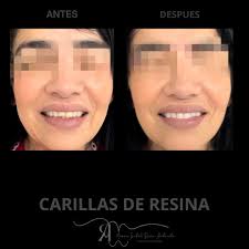 Dent. María isabel Romo 🦷 (@dra_mariaisabelromoa) • Instagram photos and  videos