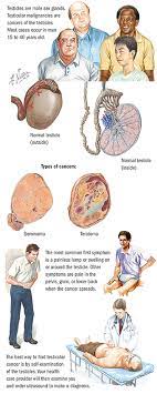 It's not clear what causes testicular cancer in most cases. Testicular Cancer Spectrum Health