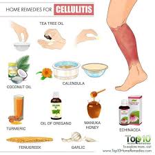 Home Remedies For Cellulitis Cellulitis Remedies Remedies Toenail Fungus Home Remedies