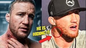 BYB 19 Fight of the Night