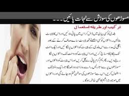 home remes to reduce gum swelling