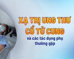 Hình ảnh về Xạ trị ung thư cổ tử cung
