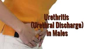 The incubation period is the time between being exposed to the virus and the onset of symptoms. Urethritis Urethral Discharge In Males Standard Treatment Guidelines