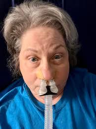 Stomach and side sleeper face mask marks solutions