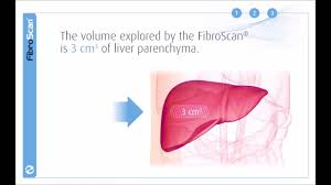 3 Stages Of The Fibroscan Examination