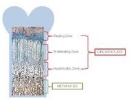 The structure of growth plate and metaphysis. The growth ...
