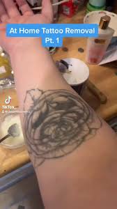 Salt and lemon juice if you looking for tattoo removal instead of laser than salt and lemon juice is a perfect home remedy to get rid of the tattoo. Discover Tattoo Removal At Home S Popular Videos Tiktok