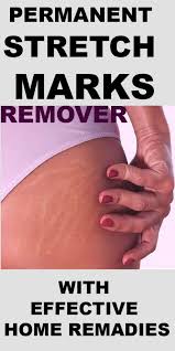 Pin By Asmara Asmars On Fg In 2020 Stretch Marks Stretch Marks On Thighs Stretch Marks On Legs