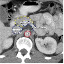Ultrasound Abdomen General Indication Technique This Course Provides General Information About U In 2020 Ultrasound Ultrasound Sonography Diagnostic Medical Sonography