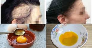 Tieni l'uovo in verticale sopra un secondo recipiente e stacca delicatamente la metà superiore del guscio. Mescola Questi 3 Ingredienti Per Una Ricrescita Immediata Dei Capelli Rimedio Naturale