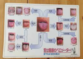 舌に歯型が残っている | ◇相談できる店◇ 漢方草庵 泰山堂@川崎駅前