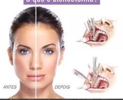 La extracción de la bolsas de bichat llamada también bichectomia es una intervención quirúrgica que se aplica a la estética facial, consiguiendo mejorar el contorno de las. A Bichectomia E Que Um Procedimento Cirurgico Que Reduz O Tamanho Das Bochechas E Deixa O Rosto Com Um Aspecto Mais Fino Toluna
