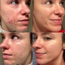 Happy National Esthetician Day 🎉 I will never be able to fully describe  the joy and gratitude I feel to have found the career of my dreams! As an  esthetician I have