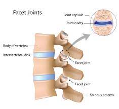 The facet joints, zygapophyseal joints, are at the back of the spine. Lumbar Facet Joint Injection Information