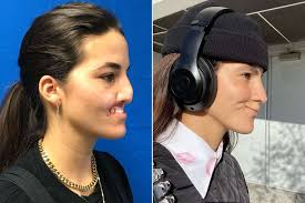 Brooklinn Khoury's Lip Was Thrown 'in the Trash' After Dog Attack