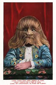 Image result for Hypertrichosis