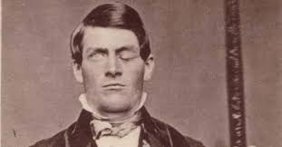 19 Famous People Driven Insane by Voices in Their Heads