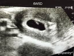 Confirming the baby's heartbeat and your due date; Pregnancy 2 A Flickering Heartbeat At My 6w5d Ultrasound Scan Budgetpantry Singapore Mummy Blog On Food Recipe Baby