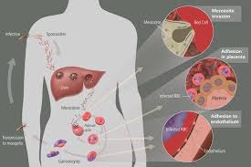 The parasites are transferred to humans by the bite of an infected anopheles mosquito. Malaria Pathophysiology Wikidoc