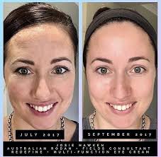 Rodan and Fields