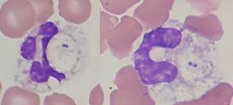 Image result for Intracellular Bacteria