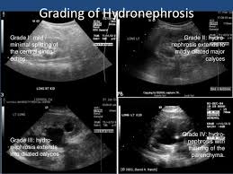 Aua Ultrasound 1 40 638 Jpg 638 479 Pixels Diagnostic Imaging Ultrasound Ultrasound Tech